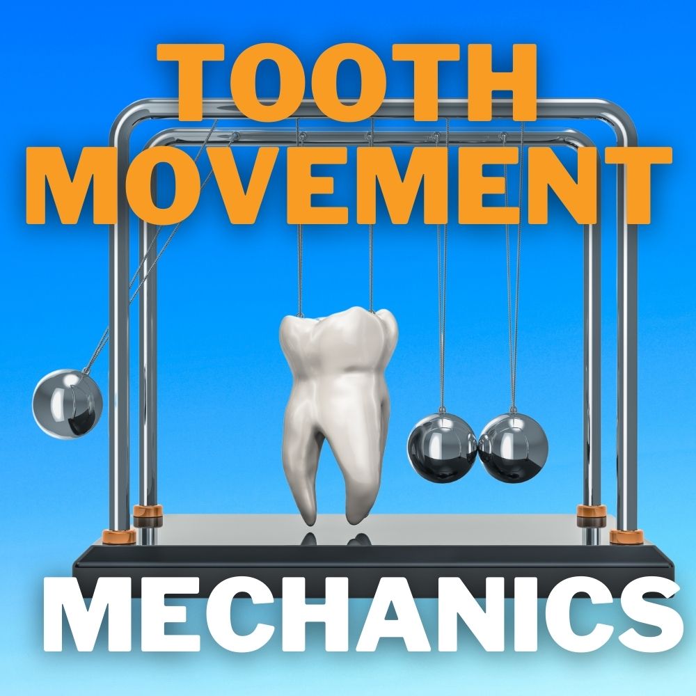 Basic tooth movement mechanics