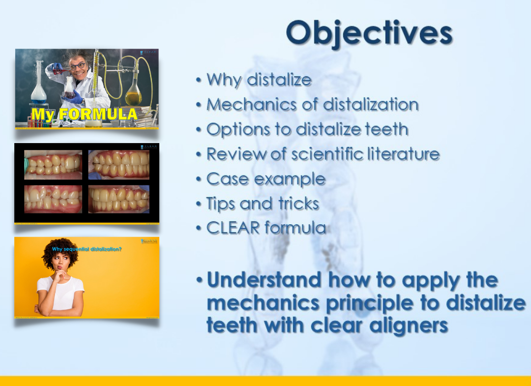 Distalization mechanics with clear aligners